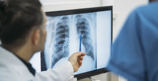 Close up of doctors analysing radiological chest x-ray film